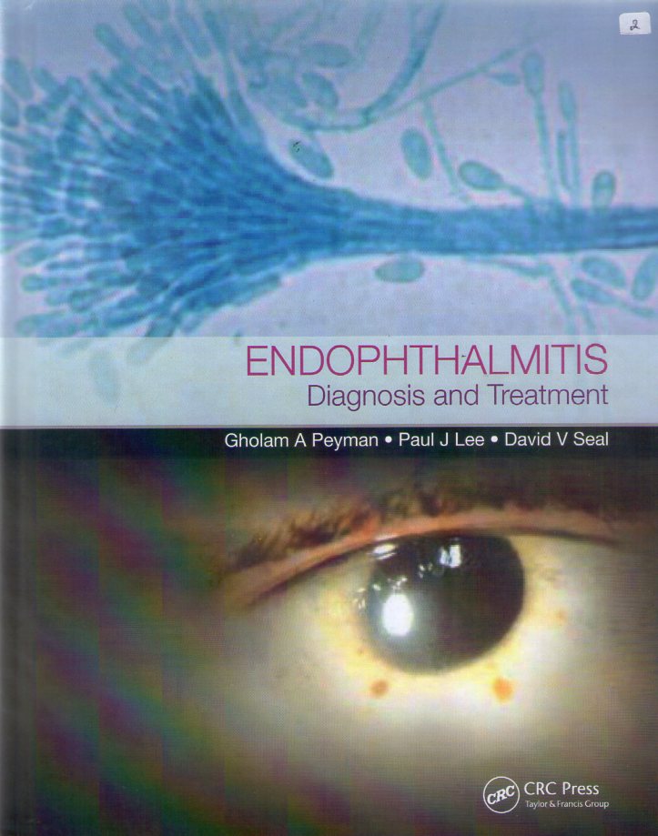 endophthalmitis diagnosis and treatment