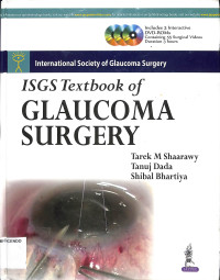 ISGS textbook of glaucoma surgery