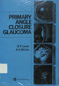 primary angle closure glaucoma