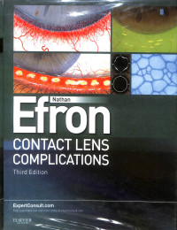 contact lens complications third edition