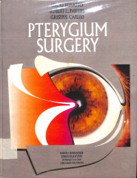 pterygium surgery