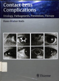 contact lens comlications, etiology, pathogenesis, prevention, therapy