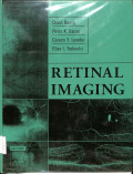 retinal imaging