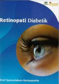 retinopati diabetik