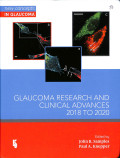 Glaucoma research and clinical advances 2018 to 2020