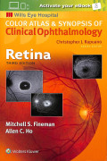 Color atlas & synopsis of clinical ophthtalmology  retina third edition