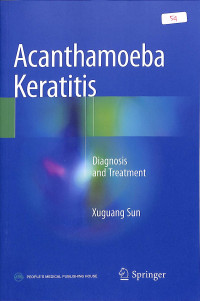 Acanthamoeba Keratitis , diagnosis and treatment