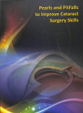 Pearls and pitfalls to improve cataract surgery skill