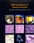 WHO Classification of tumours of the eye