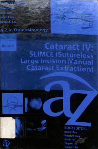 a-z in ophthalmology , cataract IV: SLIMCE (Sutureless large incision manual cataract extraction)