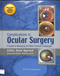 Complications in ocular surgery , aguide to managing the most common challenges