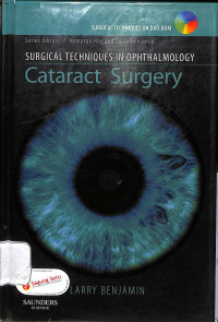 surgical techniques in ophthalmology , cataract surgery