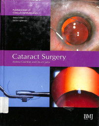 caract surgery