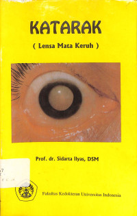 katarak (lensa mata keruh)