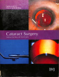 cataract surgery