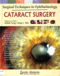 Surgical techniques in ophthalmology cataract surgery