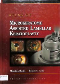 atlas of microkeratome assisted lamellar keratoplasty