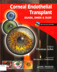 Corneal Endothelial Transplant