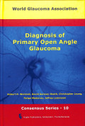 Diagnosis of primary open angle glaucoma