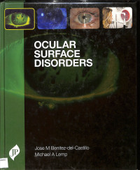 Ocular surface disorders