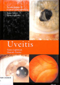 uveitis