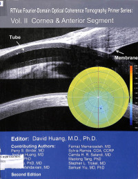 rtvue fourier domain optical coherence tomography primer series, vol II cornea & anterior segment