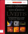 uveitis fundamentals and clinical practice