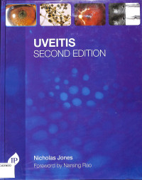 Uveitis second edition