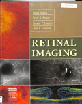 retinal imaging