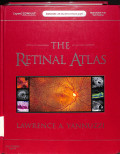 the retinal atlas