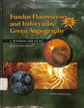 fundus fluorescein and indocyanine green angiography, a textbook and atlas