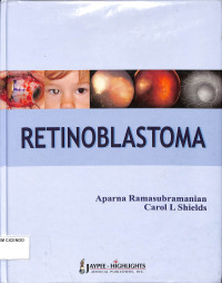 retinoblastoma