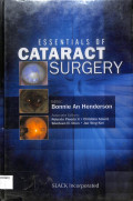 essentials of cataract surgery