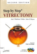 step by step vitrectomy