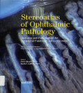 stereoatlas of ophthalmic pathology, anatomy and pathology of the peripheral fundus (fundus extremus)