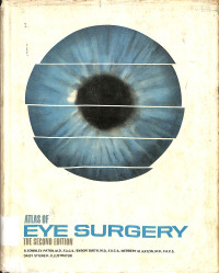 atlas of eye surgery the second edition