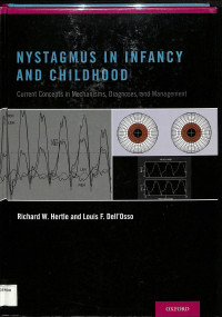 nystagmus in infancy and childhood current concepts in mechanisms, diagnoses, and management