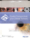 eyelid , conjunctival, and orbital tumors an atlas and textbook