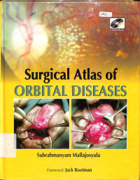 surgical atlas of orbital diseases