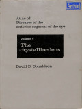 atlas of diseases of the anterior segmetn of the eye