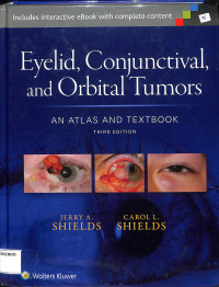 eyelid,conjuntival,and orbital tumor an orbital tumors an atlas and textbook third edition