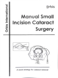 orbis international, manual small incision cataract surgery, a novel strategy for cataract removal