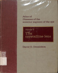 atlas of diseases of the anterior segment of the eye