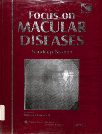 focus on macular diseases