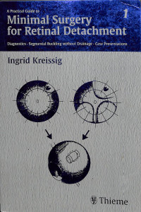 a practical guide to minimal surgery for retinal detachment, diagnostics segmental buckling without drainage case presentations