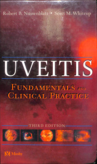 uveitis fundamentals and clinical practice