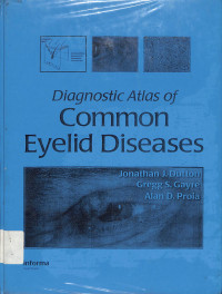 diagnostic atlas of common eyelid disease