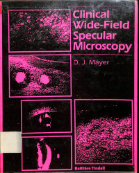 clinical wide field spcular microscopy