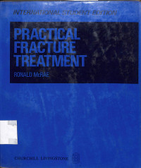 practical fracture treatment