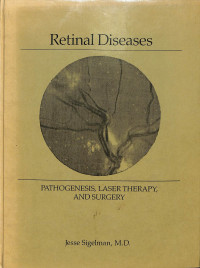 retinal diseases